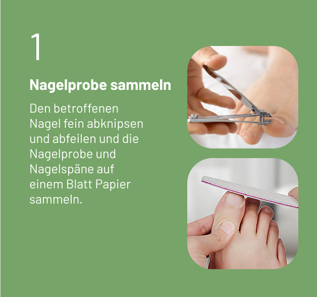 Nagelpilz PCR-Test
